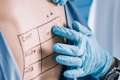 Average Cost of Allergy Testing